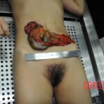 Autopsy of stabbed girl