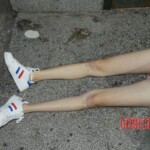 Overdosed chinese girl