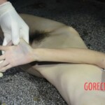 Overdosed chinese girl