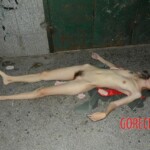 Overdosed chinese girl