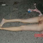 Overdosed chinese girl