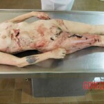 Female heroin user in morgue