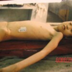 Naked dead girl in morgue