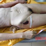 Mother and daughter in morgue