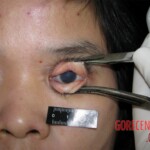 Raped and murdered woman