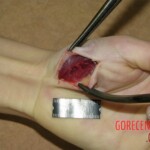 Raped and murdered woman