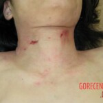 Raped and murdered woman