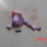 Raped and murdered woman