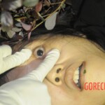 Female corpse
