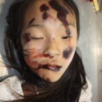 Young girl in morgue