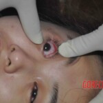 Dead young chinese girl