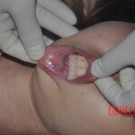 Dead young chinese girl