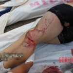 Girl died in car accident