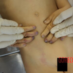 Young girl died in hospital