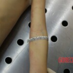 Autopsy of young girl