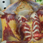 Autopsy of young girl