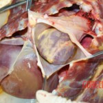 Autopsy of young girl