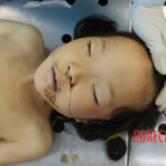 Young girl died in hospital