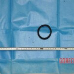 Autopsy of young woman