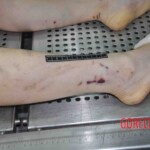 Autopsy of young woman