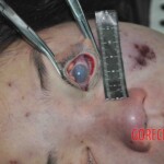 Autopsy of young woman