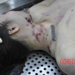 Autopsy of young woman