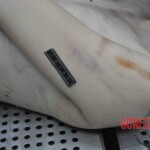 Autopsy of young woman