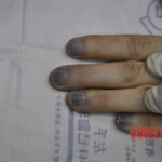 Autopsy of young woman