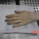 Autopsy of young woman