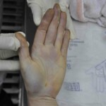 Autopsy of young woman