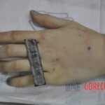 Autopsy of young woman