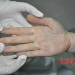 Autopsy of young woman