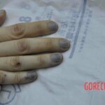 Autopsy of young woman