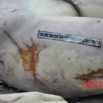 Autopsy of young woman