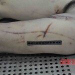 Autopsy of young woman