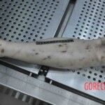 Autopsy of young woman