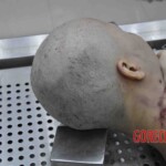 Autopsy of young woman