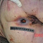 Autopsy of young woman