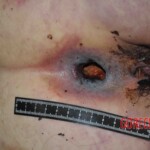 Autopsy of young woman