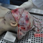 Autopsy of young woman