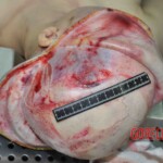 Autopsy of young woman