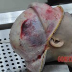 Autopsy of young woman