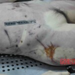 Autopsy of young woman