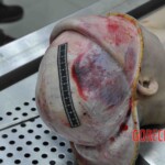 Autopsy of young woman