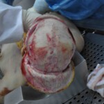 Autopsy of young woman