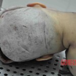 Autopsy of young woman