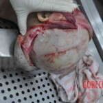 Autopsy of young woman