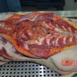 Autopsy of young woman