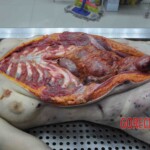 Autopsy of young woman