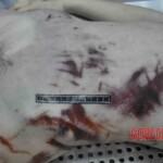 Autopsy of young woman